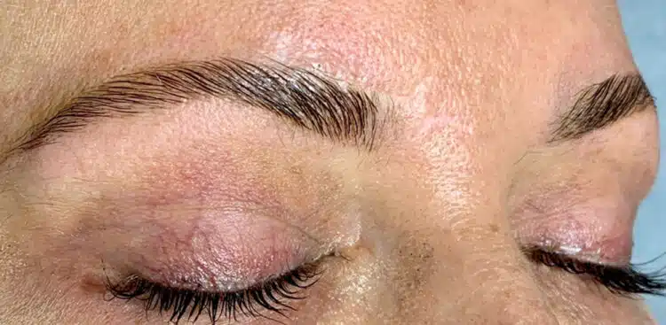 Brows_10_after