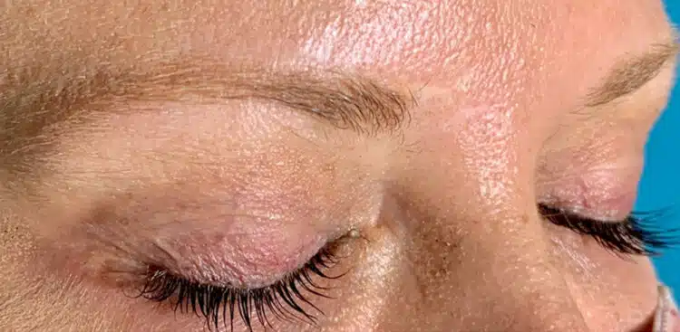 Brows_10_before