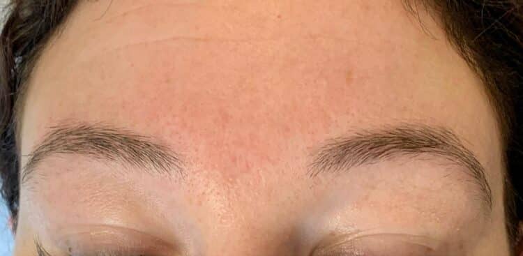 Brows_12_before