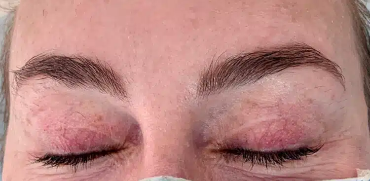 Brows_16_before