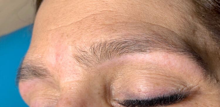 Brows_17_before