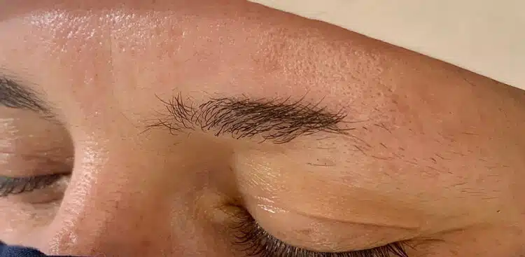 Brows_8_before