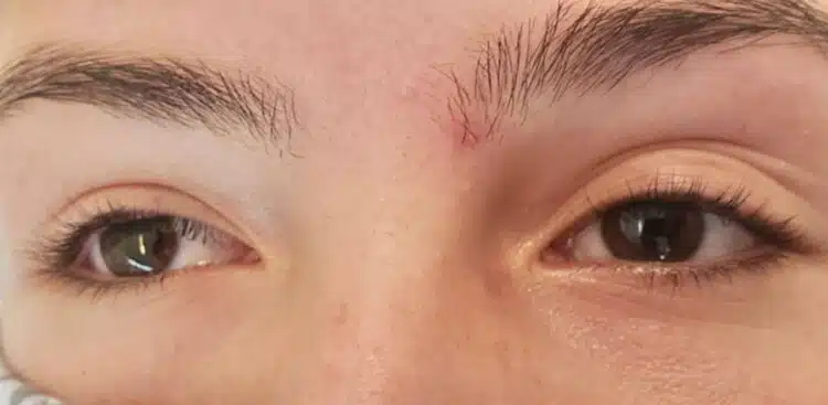 Lash_Lift_5_before