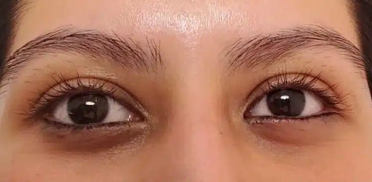 Lash_Lift_6_before