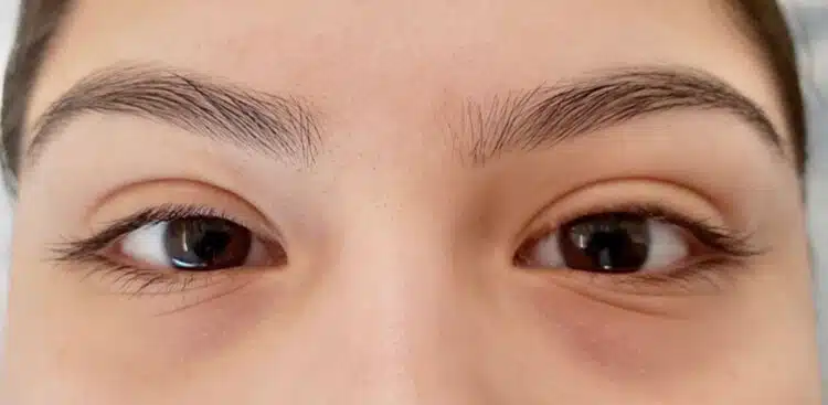 Lash_Lift_8_before
