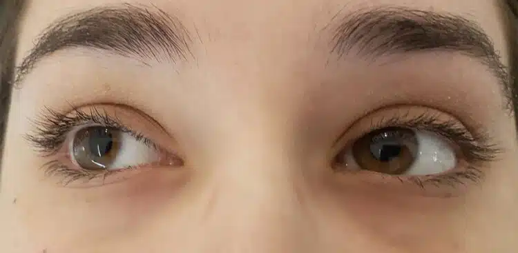 Lash_Lift_9_before