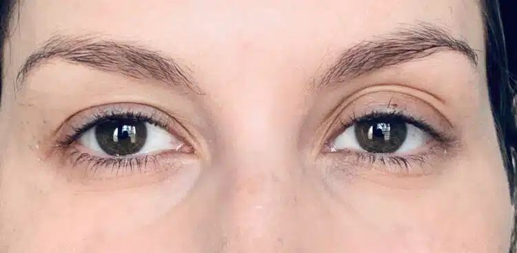 Lashes_11_before