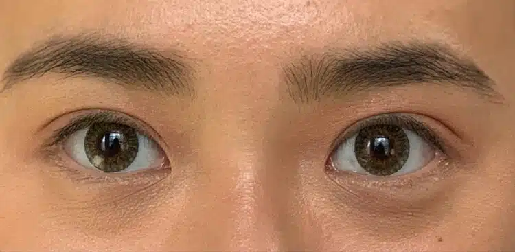 Lashes_18_before