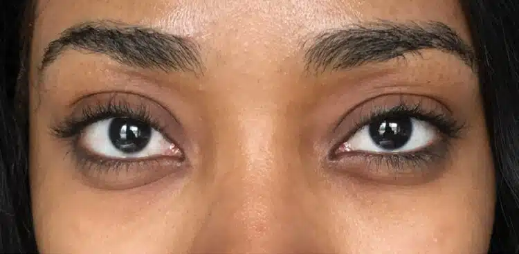 Lashes_20_before