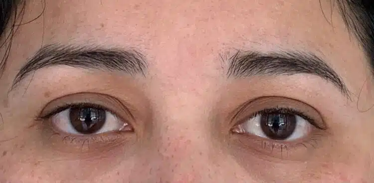 Lashes_23_before