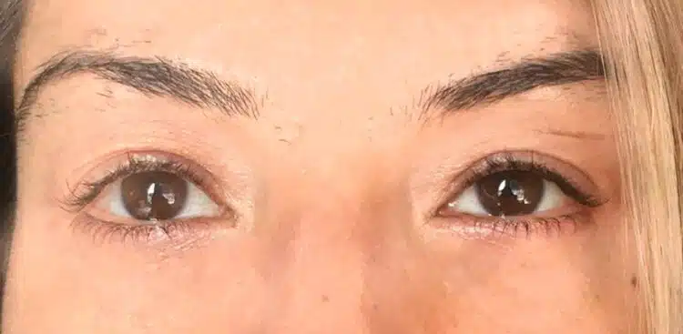 Lashes_24_before
