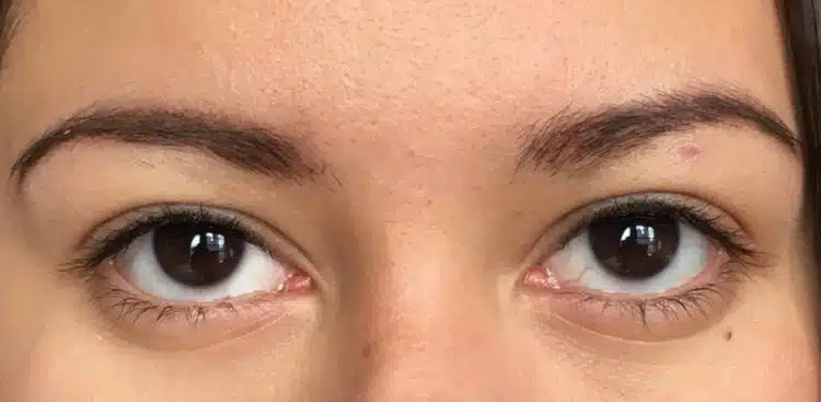 Lashes_26_before