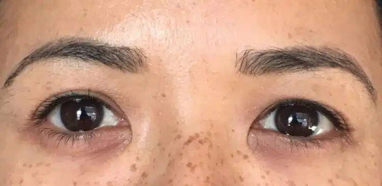 Lashes_27_before