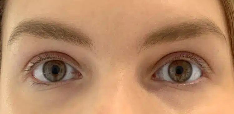 Lashes_5_before