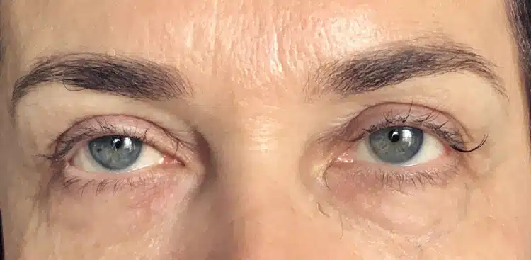 Lashes_8_before