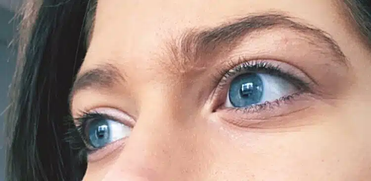 Lashes_9_before