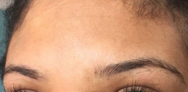 brows-before-after-1b