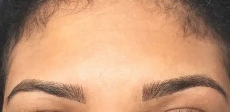 brows-before-after-3a