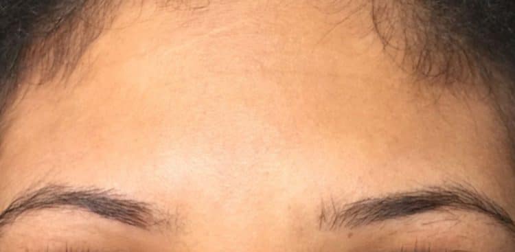 brows-before-after-3b