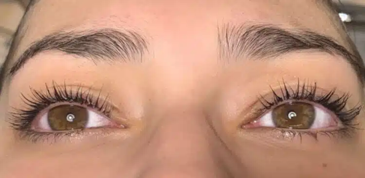 lifts-before-after-3a