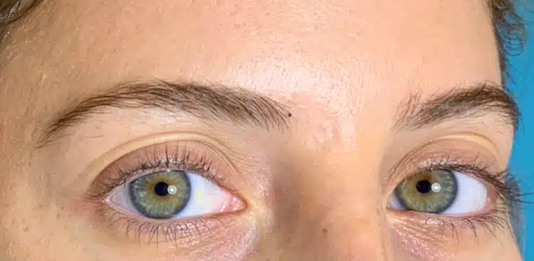 Brows_19_before