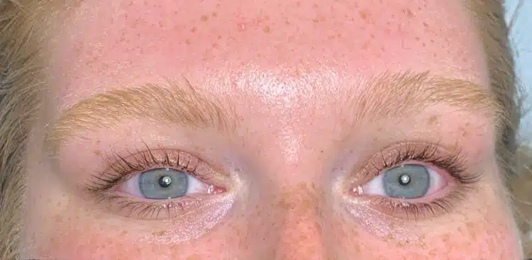 Brows_22_before