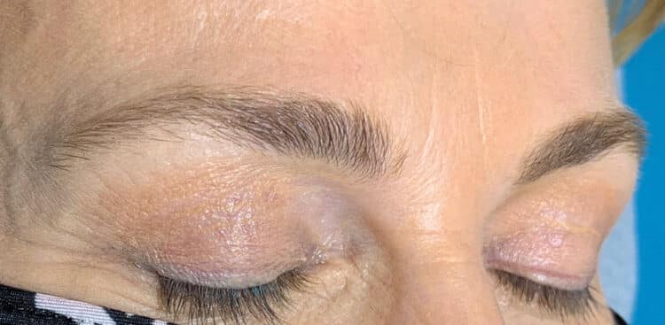 Brows_24_before