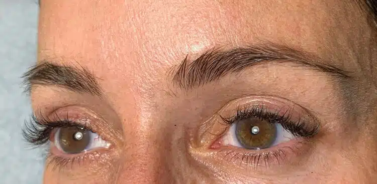 Brows_25_before
