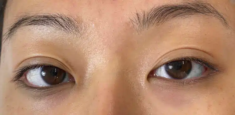 Lash_Lift_13_before