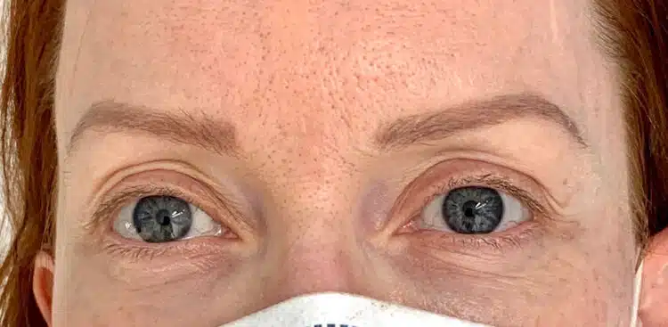 Lashes_28_before