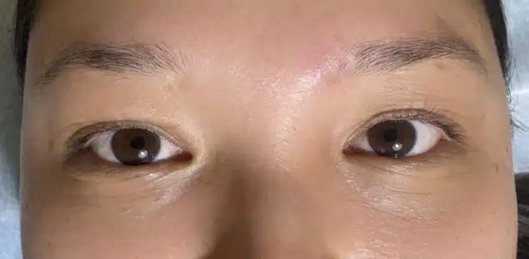 lashes_31_before