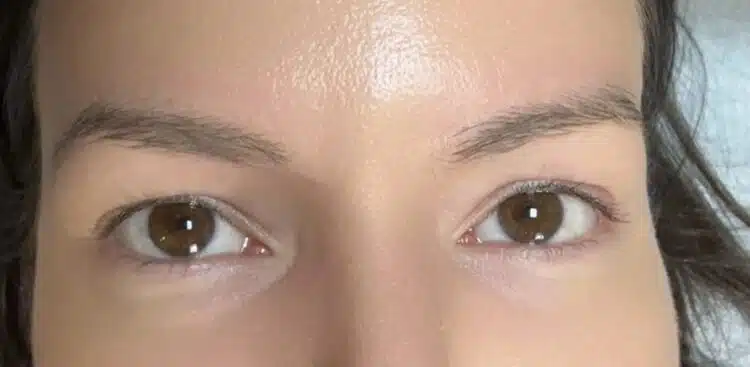 lashes_32_before